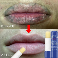 Exfoliating Lip Balm